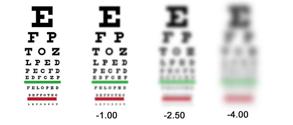 眼睛度數不代表視力品質．視力篇（上）－光明分子．眼鏡